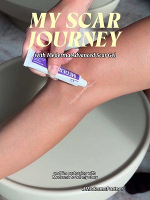 Scars tell stories 🤍 and @Mederma Advanced Scar Gel has supported me, as my story continues to write itself 📖 -making me feel confident and empowered :) #MedermaPartner #Mederma #SkinTok 