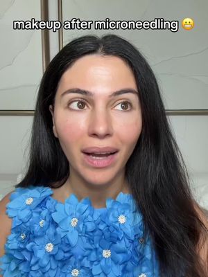 I didn’t realize what a difference face makeup actually makes 🫠 but I loved my microneedling results so I wasn’t willing to risk the recovery! #microneedling #makeup #nomakeup 