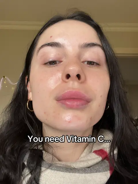If your skin is breaking out, red, raw or stinging… stop reaching for another acid. Fix your barrier first. Panthenol helps calm inflammation, while azelaic acid targets acne and post inflammatory marks. This is how you treat acne without destroying your skin in the process 🤍