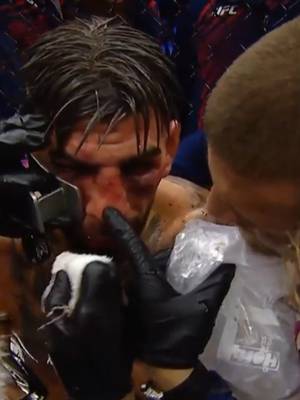 The damage is showing on Ilia 😬 #UFC #mma #UFCWhiteHouse #iliatopuria