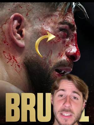 Ilia Topuria Medical Update! #UFC #mma 