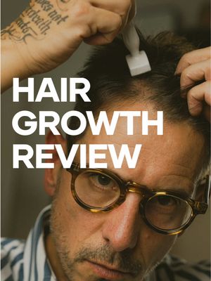 Like most middle aged men, thinning hair is something we quietly live with but never speak about. Mine started about 10 years ago and I secretly hoped it just wasn’t the case. Unfortunately, it never came back and now I’ve finally decided to start doing something about it.  Having read up on how bad the side effects of Minoxidil and Propecia can be, I decided to try an alternative and teamed up with the folks at @Calecim Professional to give their 6 week treatment a go.  This review is about as honest as it gets and I hope it’s a good first step at letting men feel comfortable about something that affects us and our confidence daily.  As I mentioned in the video, while new growth is harder to see visually the texture of my hair improved massively. The Hair Serum has been shown to increase hair strand thickness by 16%, which may help explain why hair can look and feel fuller during the process. If you think the results are as satisfactory as I do and wanna give it a try you can use my discount code: WMBW15 to grab 15% off.  If you have any questions simply pop them down below.  #hairgrowth #menshair #thinninghairsolution #hairgrowthtips 