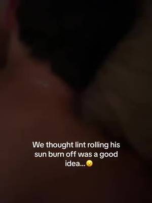 Sunburn hack 😦 (🎥:@Sara Pelletier) 