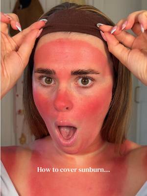 How to cover sunburn 101 🥵 @Makeup Revolution colour corrector @nyxcosmetics_uk foundation @SHEGLAM bronzer @essence cosmetics blush,lipgloss @rimmellondon lipliner @MaybellineUK concealer #makeuptrends #makeuphacks #sunburn #colourcorrection 