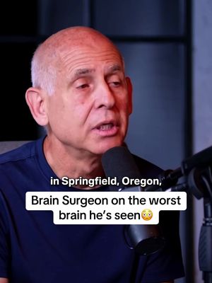 Dr Amen has scanned over 250,000 brains, this was the most unhealthy😳@The Diary Of A CEO #thediaryofaceopodcast #diaryofaceo #podcasts #brainsurgeon 