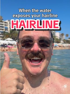 When the water exposes your hairline 🌊🫪 Followed by the walk of shame back to the sun-lounger, now 90% balder and picking my wet swimming trunks out of my private parts. Cast in order of appearance… My girlfriend: @ Idontknowhowimanagediteither Handsome Balding Male: @ me Background Seagull: @ Seagull Send to a fellow recedeKING 💌  #Men #Hairline #Comedy #Holiday #Relatable 