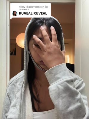 Replying to @pereylierge on ig face reveal :) two weeks post op ! @Dr. Ruthlyn Pecolera-Salvosa  made it happen! 