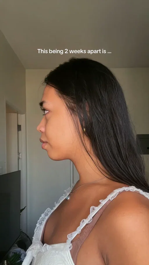 @Dr. Ruthlyn Pecolera-Salvosa  fulfilled my vision to reality 🤩