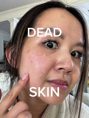 AD The viral Dr. Melaxin Peel Shot Ampoule is finally at Costco Canada!  ✨ This gentle K-beauty exfoliator helps lift away dead skin while supporting your skin’s moisture barrier for smoother, brighter, more hydrated-looking skin. Plus, you get TWO in an exclusive value pack! 🤍 #costcocanada #costco #koreanskincare 