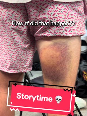Rub some dirt on it  #bananaball #ouch #bruises #baseball #storytime 