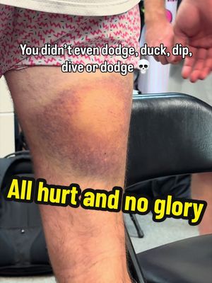 Just an Average Joe 🤷🏻‍♂️ #dodgeball #averagejoe #ouch #savannahbananas #partyanimals 
