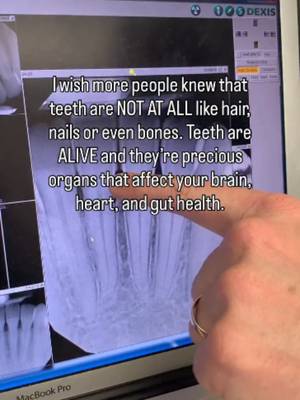 If you thought teeth were just about avoiding fillings and tricking your hygienist into thinking you floss, oh wow, do I have your next rabbit hole. Follow me and message me the word NEWSLETTER to join 200K people learning about the latest mouth-body science and what it means for your health, all for free. -Dr. B