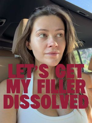I’ve been putting this off for way too long, but let’s get my filler dissolved 👄
