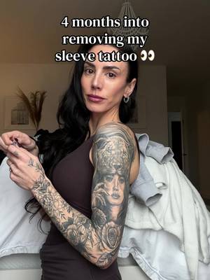 4 months in and more to go but here’s a little update on my sleeve removal 🤍 #tattooremoval #MomsofTikTok #inked 