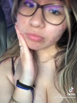 Miss the blonde #fypシ #me 