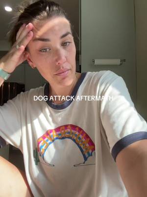 Welp #rachonlife #dogbite #millennialmom 