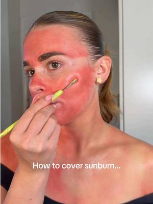I did it again 🥲 I’m now the pro at covering sunburn 🤭 @Trouble Maker Beauty green paint @nyxcosmetics_uk foundation,bronzer,concealer @SHEGLAM bronzer @Makeup Revolution blush @MCoBeauty UK powder @e.l.f. Cosmetics UK spray @Wonderskin 💋 lipliner @MaybellineUK lipgloss,mascara #makeuptrends #makeuphacks #sunburn #tanlines #sunburnrelief 