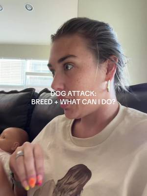 Y’all keep asking, so here ya go!!!! #rachonlife #millennialmom #dogbite #motherhood 