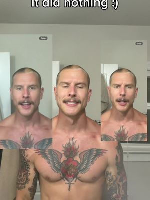 I think the toner made it even more bald spot looking 