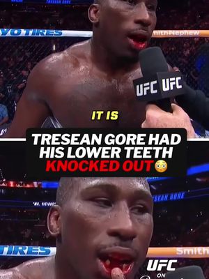 Going back with some teeth in his pocket 🦷 #ufc330 #UFC #fights #treseangore #philadelphia 