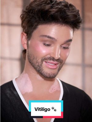 Let’s chat about vitiligo 🐾