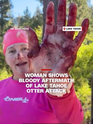 A swimmer is recovering after she says she was attacked by a river otter in Lake Tahoe. CNN affiliate KGO spoke with Lynnette Bellin about the incident.