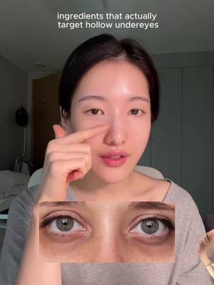 Getting rid of hollow undereyes, fine lines  #eyecream #wrinkles #pdrn #antiaging #undereye