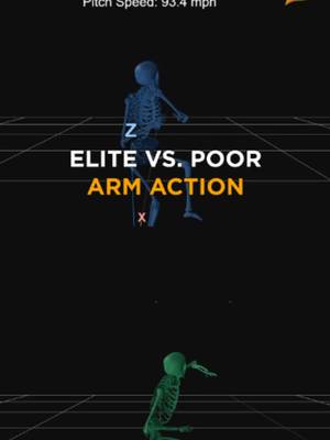 Break down: Two throwers from the lab this summer. Both sat 93.4. One has the highest graded arm action of anyone we saw hit 92+, worth +3.1 mph of expected velo from the arm action alone. The other graded 16th percentile, worth -2.2. A 5.3 mph spread in what the arm contributes, and it shows up nowhere in the pitch speed. TOP: middle out Everything close to his center is elite, and it falls apart at the ends. Elite drift into leg lift (97th), good hip to shoulder separation at landing (78th), then he closes it fast (98th max torso rotational velo). The arm action does the opposite: not much layback (28th max shoulder ER), and what he creates doesn't convert into speed (14th max shoulder IR velo). Cleaning that up is a big part of our focus going forward, but the fix isn't isolated to the arm. Problems late in the sequence usually start earlier. Look at the lead leg block: knee extension from foot plant to release 13th, knee extension velo at release 19th. Our read is the front side isn't stable enough for the momentum he's generating, and it's hard to pull the arm through the positions we want without a firm base to rotate against. BOTTOM: the opposite problem The arm is the engine. 96th percentile layback, 91st arm speed out of it. And the front leg does what the top guy's doesn't, 97th lead knee extension velo at release. He plants, braces, the arm pulls through. What's holding him back is the trunk: 18th max torso rotational velo, and torso forward tilt at MER in the 2nd percentile, so he's bent toward the plate before the arm gets there. The top guy moves more energy down his arm and his elbow takes less stress for every unit of it. The bottom guy moves less energy, turns more of it into ball speed, and accrues more elbow torque per unit.