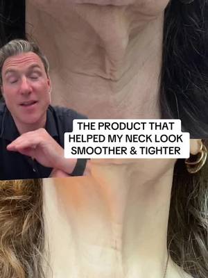 our community’s neck stick results speaks for itself 🙌🏽🤩 #theinkeylist #neckstick 