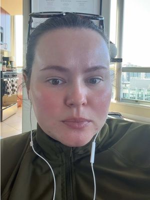 Yes I am the pimple police #pcos #hashimotos #pmos 