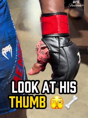 The bone in Alonzo Menifield’s thumb is protruding from his hand 😨🤮 [ #UFC331 | LIVE on @Paramount+ ]