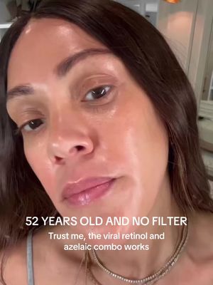 This is why it looks like when you alternate my Retinol Reform and Rescue Serum, glowing glass skin #laesthetician #retinol #retinolreform #azelaicacid #Estheticianrecommendations 