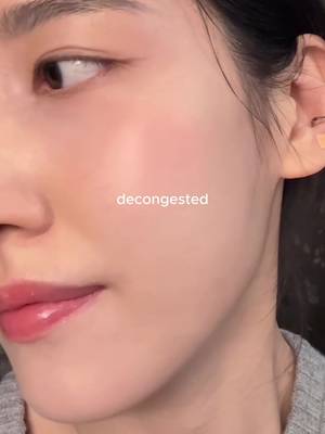 Retinoids+azelaic acid with barrier care on other days #koreanskincare #skintok #skincareroutine #cloggedpores #congestedskin 