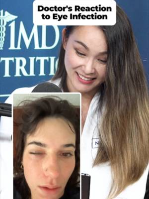 Is an Eye Infection Really What You Think? 👁️👇 That severe eye bump might not be a dangerous corneal ulcer. Here is what an ophthalmologist wants you to know about swollen eye bumps and styes: 1️⃣ It Might Be a Stye: Many severe eye bumps are actually aggressive styes located on the eyelid margin rather than the eyeball itself. 2️⃣ Clogged Oil Glands: Styes often form when eyelid oil glands get clogged, leading to localized swelling and inflammation. 3️⃣ Why You Must Always Remove Makeup: Leaving mascara or eyeliner on overnight blocks those delicate oil glands, making severe styes and inflammation far more likely to develop. 🧼 4️⃣ Inflammation vs Infection: Most painful eyelid bumps are primarily localized inflammation resembling a pimple rather than a deep corneal infection. 5️⃣ Nourish Your Eyes: Supporting your tear film and eye health with essential nutrients like omega-3s helps maintain natural gland function. 🥕 Because Your Health Is Our Mission.® At 1MD Nutrition®, we are committed to helping you live a longer, healthier life by combining doctor-formulated supplements with clinically tested, natural ingredients. Our mission is to provide science-backed solutions you can trust for optimal eye, gut, and overall body wellness. 🩺✨ 👉 Click the link in our bio to shop our doctor-formulated supplements today! 👁️🔗 #EyeHealth #OphthalmologistReaction #VisionCare #EyeStye #1MDNutrition