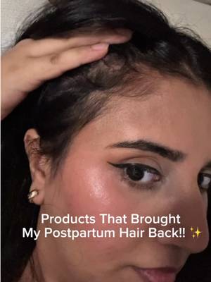 My hair is FINALLY growing back 🥹🤍 Postpartum hair loss really took a toll on my confidence. Watching so much of my hair fall out and seeing how thin it became was honestly heartbreaking. These have been some of the products I’ve consistently reached for throughout my hair regrowth journey: Briogeo Destined for Density, Dr. Groot Revitalize Scalp Serum, and Joico Moisture Recovery Shampoo + Conditioner. I’m finally seeing those little baby hairs coming back, and it feels so good to slowly feel like myself again. 🥹✨ If you’re going through postpartum hair loss too, just know you’re not alone. 🤍 #postpartumhair #hairloss #hair @Bri@Briogeoico Hair Care 