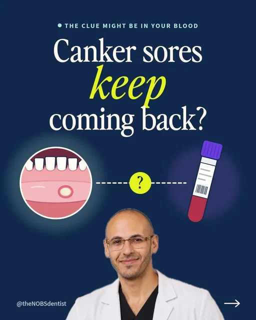 Canker sores that keep coming back aren't just bad luck. They aren't contagious and they aren't herpes. They're immune-driven: once a sore opens, killer T cells outnumber helper T cells about 10 to 1 in the tissue underneath. What sets them off is still unknown. Nutrients matter too. In one study, people with recurring sores were twice as likely to be low on iron, B12 or folate (17.7% vs 8.5%). When the 23 who were low got it replaced, 15 stopped getting sores and 8 got better. That same blood work turned up pernicious anemia and celiac disease, both autoimmune. In a separate trial, 1,000 mcg of B12 under the tongue nightly helped even in people with normal levels: 74.1% vs 32.0% had no sores in month 6. A standard daily multivitamin made no real difference. If yours keep coming back, ask for a blood count, ferritin, B12, folate, vitamin D and a celiac test. Keep eating gluten until you're tested. And try an SLS-free toothpaste; SLS is a foaming detergent that can irritate. A sore that hasn't healed in 3 weeks needs to be seen.