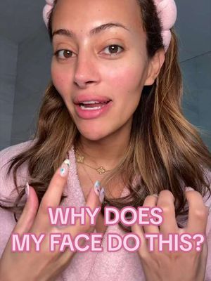my face gets SO RED after a workout and this is the only thing that actually cools it down 😭🧊 the belif Aqua Bomb Frozen Cream has these frozen capsules in it…sensitive skin girlies this one's for US 🥹 @belif USA find it @Ulta Beauty 🩷 #belifpartner #koreanskincare #kbeauty #sensitiveskin #rosacea  