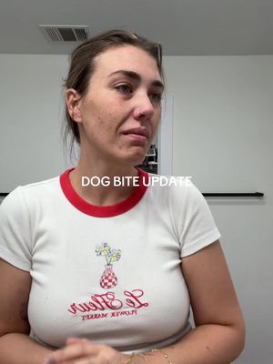 It’s not fair. This will impact her (and selfishly me) for the rest of her life. The wounds are superficial, but the trauma is layers deep. I tell her every single day that I’m sorry and that I wish I could have changed places with her that day in a heartbeat. #rachonlife #dogbite #girlmom #motherhood #millennialmom 