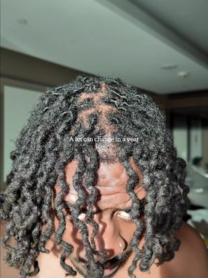 W hair transplant if you ask me. Comment below with any questions 🤝 #hairtransplant 