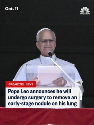 Pope Leo XIV announced Sunday that he will undergo surgery to remove an early-stage nodule on his lung.
