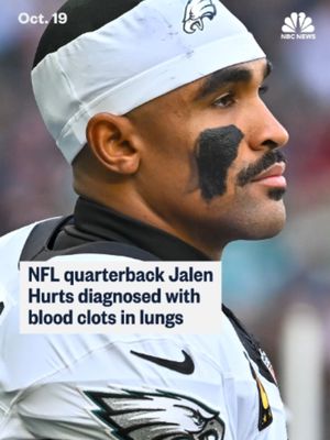Philadelphia Eagles quarterback Jalen Hurts was diagnosed with blood clots in his lungs and leg, the team said Monday, likely sidelining the Super Bowl MVP for the rest of 2026.