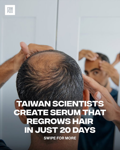Scientists create a new serum that regrows hair in 20 days 🤯 