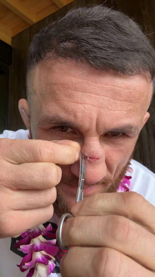 Merab Dvalishvili taking out his own stitches from the Petr Yan rematch 💪🧵

(via @MerabDvalishvil ) 