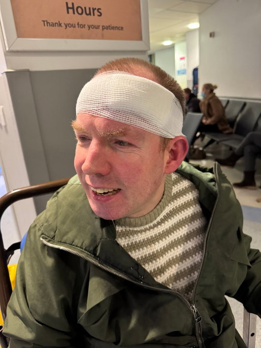 Lost Balance Guy strikes again. Fell and split my head, shows cancelled. This isn’t a post for sympathy, it’s a reminder that it’s ok to feel rubbish sometimes, and that we don’t stay down. Thanks to the NHS for fixing me. Sorry Newcastle and Mexborough for missing my shows. 