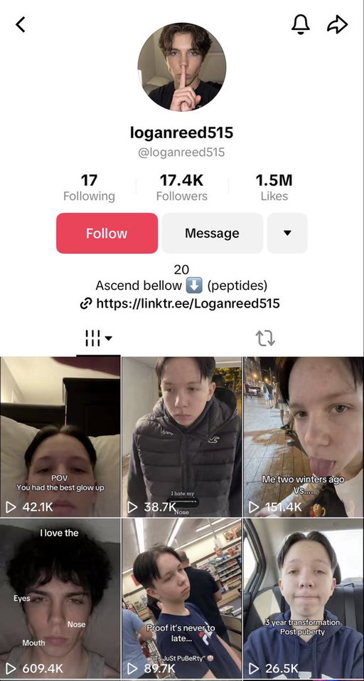 The looksmaxxing niche is going to get even crazier in 2026. Not because of Clavicular, but because it’s never been easier to generate fake “before and after” transformations using AI content… 

Within minutes, some ugly ass mf can create a folder of content which he can then distribute at scale using slideshows

Completely anonymous. 0 effort required 

If you can find an untapped market that heavily relies on “transformations” as the main selling point, you’ll print with AI because you simply just fake the photos

Some examples:

- Face westernising offer

Info offer that teaches Asians how they can look less Asian. Sounds crazy but this is in super high demand. Generate a fake Asian model that “transcended” 

- Male dick enhancement offers 

I know someone testing this right now. It’s hard to generate content for this so you need to get creative with images. Another offer that can print with AI 

- Baby glow-up offers 

Info offer for parents making their ugly ass babies look cuter. Every parent wants the cutest children. Most mothers can’t even spot the difference between real and fake content. Baby looksmaxxing

There’s probably hundreds of markets that I haven’t even thought of yet

These are just some ideas that came to mind with a few minutes of scheming