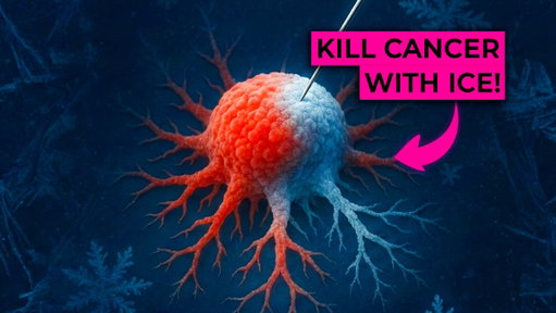 Did you know we can now kill Cancer by turning it into Ice?

New video is live deep diving how this breakthrough works, and what it means for the future 

https://t.co/A0kbN94w93 