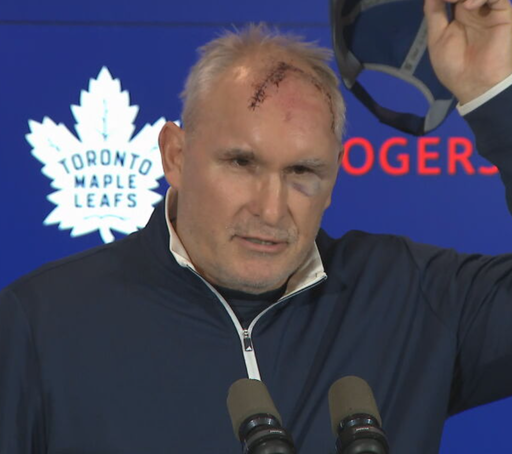 Bruh. 

Craig Berube had an accident in the gym and is looking a little worse for wear. 🤕 