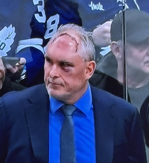 Maple Leafs coach Craig Berube had a "gym accident."

HOCKEY GUY.

via @Covers | #LeafsForever 