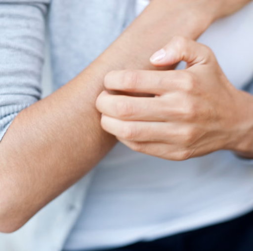 Our kidneys are absolute powerhouses, but 1M+ people in the UK are living with #KidneyDisease without even knowing it. 🚨

Don't ignore the "silent" signs:
📉 Exhaustion
🧬 Itchy skin
🚽 Changes to your wee
🦵 Swelling

Take 2 minutes to check your risk: 🔗https://t.co/Vwollv7TJU
#WorldKidneyDay #BloodyAmazingKidneys #HealthTips #CKD @kidneycareuk