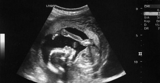 we started out just friends and now we having one ❤️ can't wait to be your dad! 